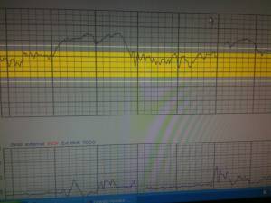 Baby Heart Beat Rate Chart