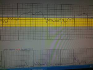 Baby Heart Beat Chart